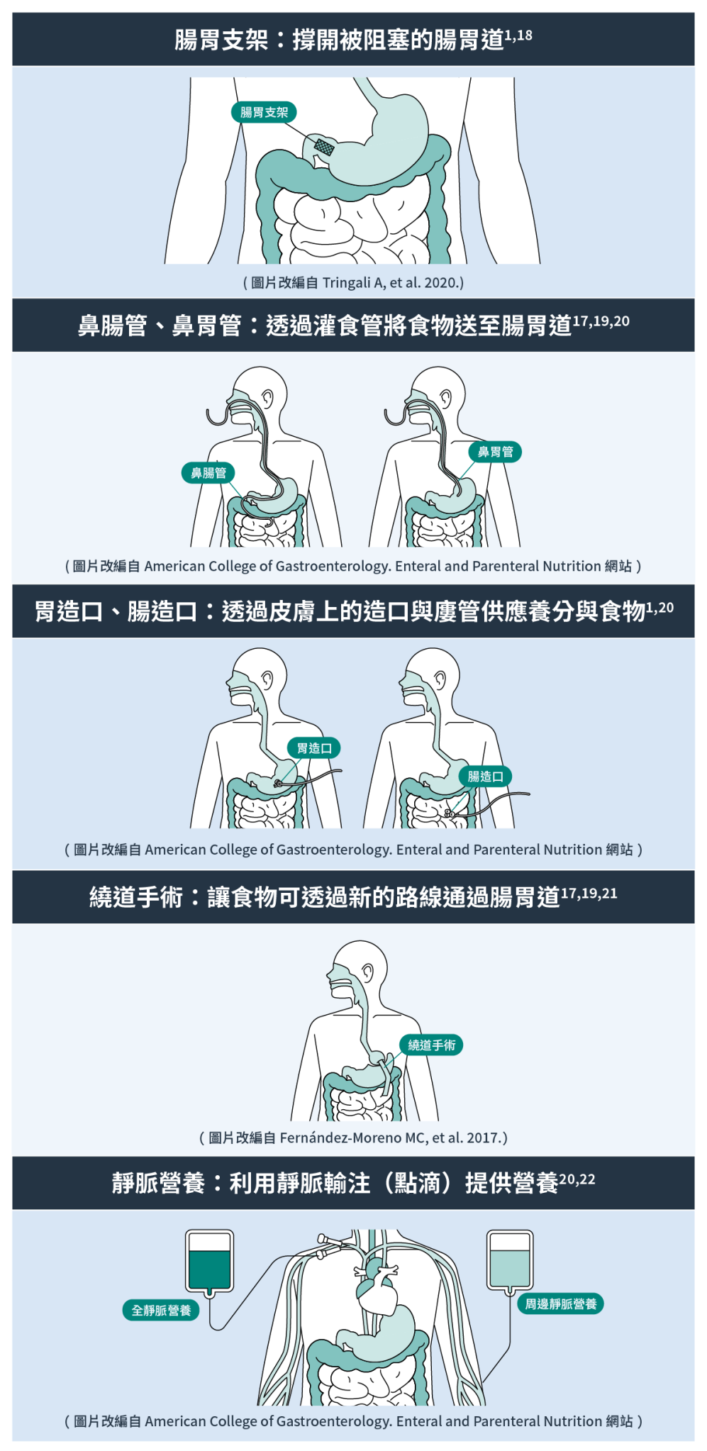 無法進食該怎麼辦？ - 醫師會評估您的狀況建議適合的營養供應方式