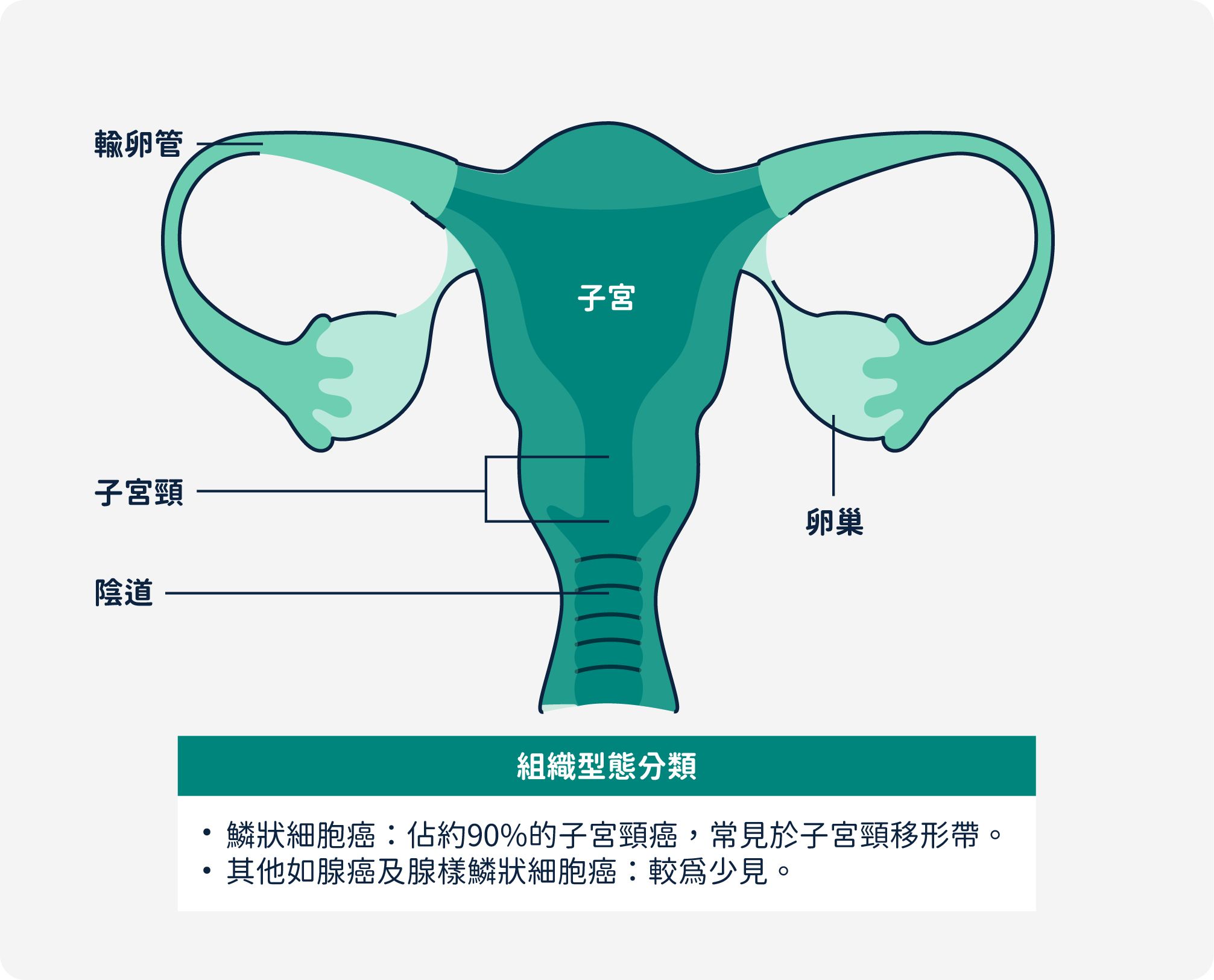 子宮頸癌組織型態分類