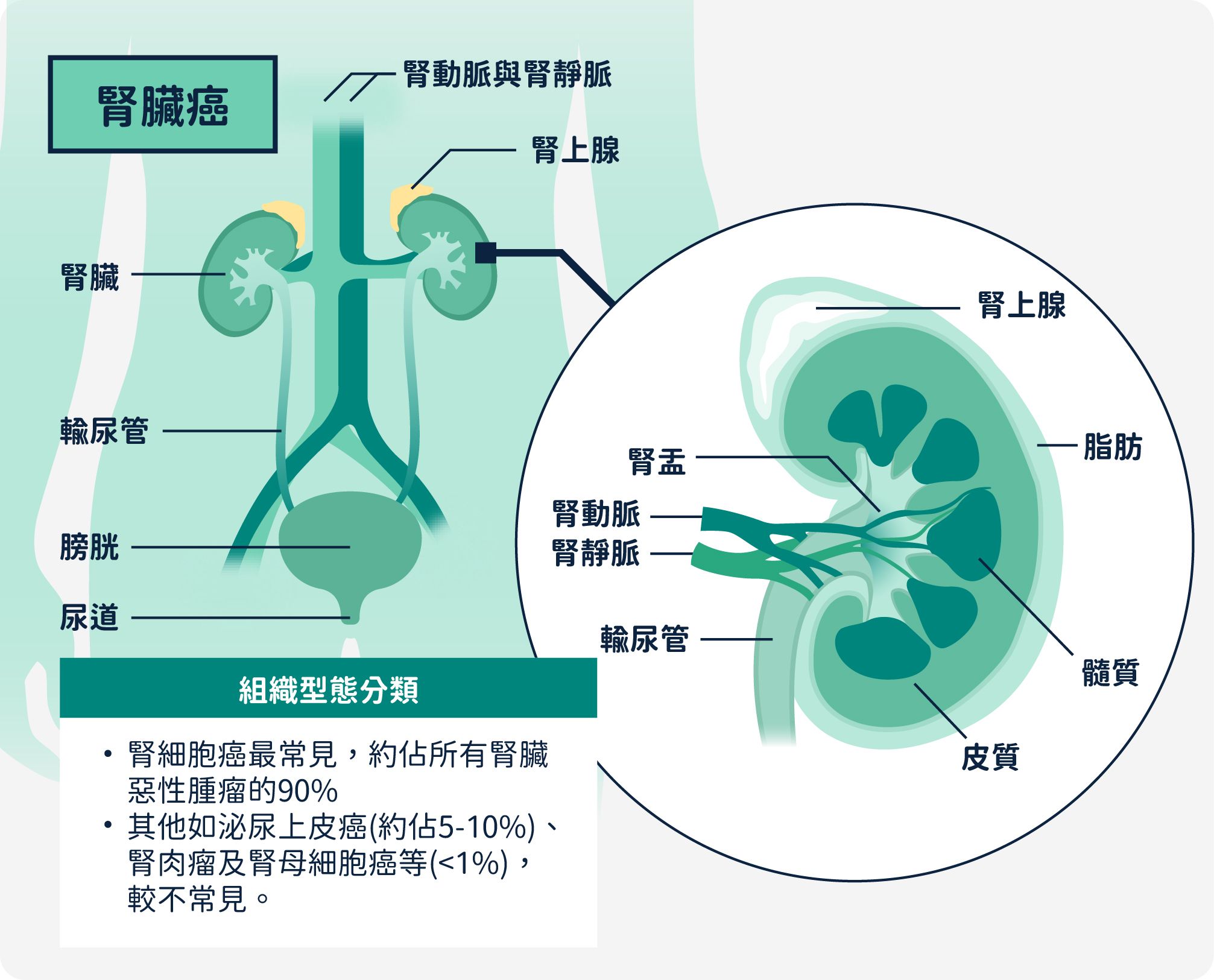 腎臟癌組織型態分類