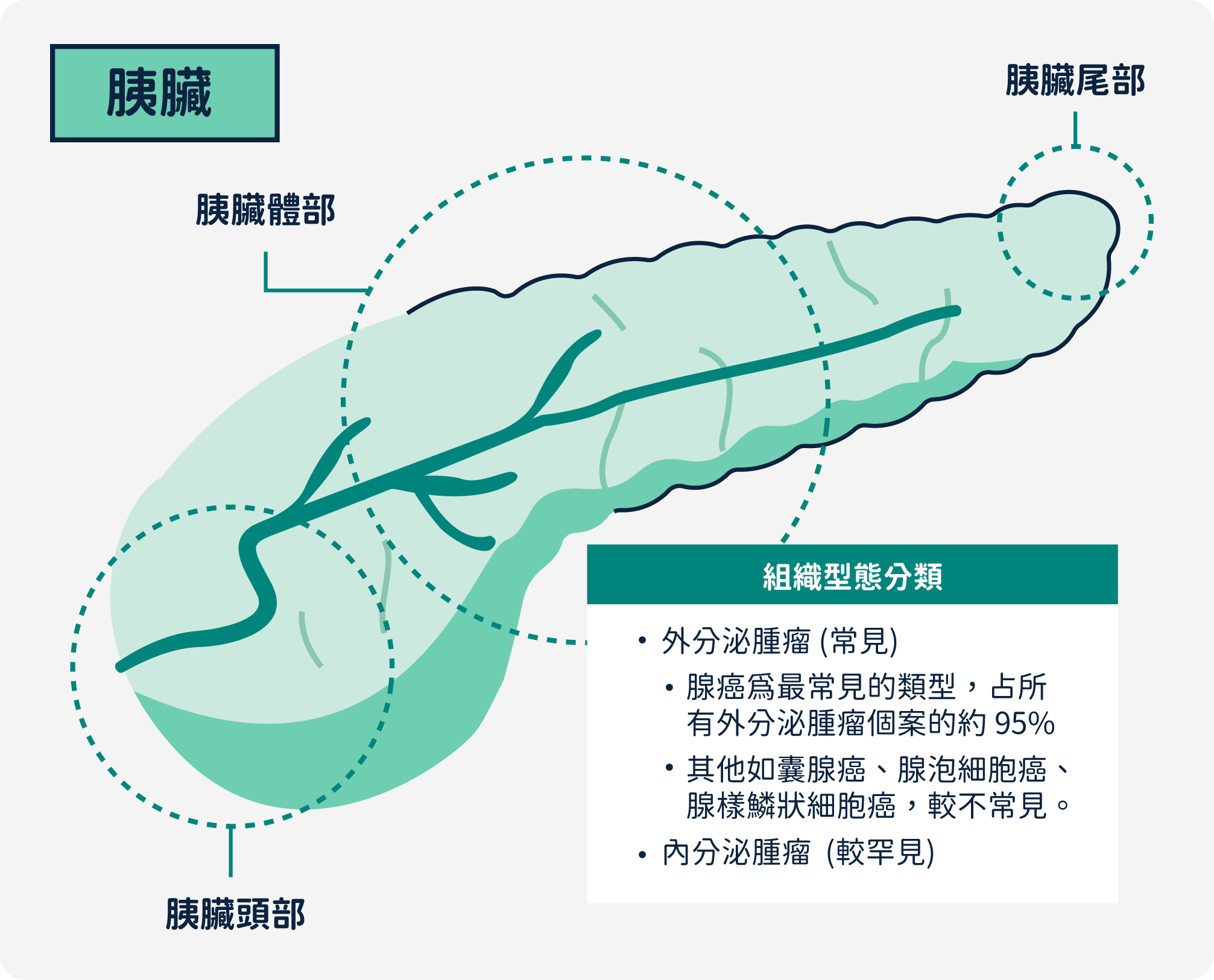 胰臟癌 - MSD Healthcare