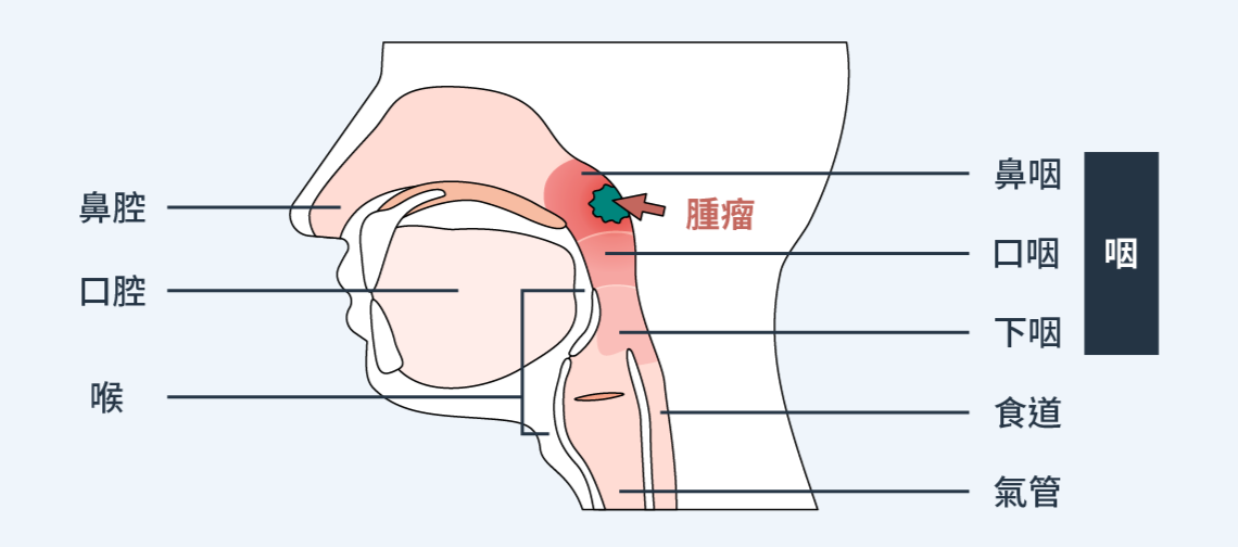 鼻咽癌發生部位