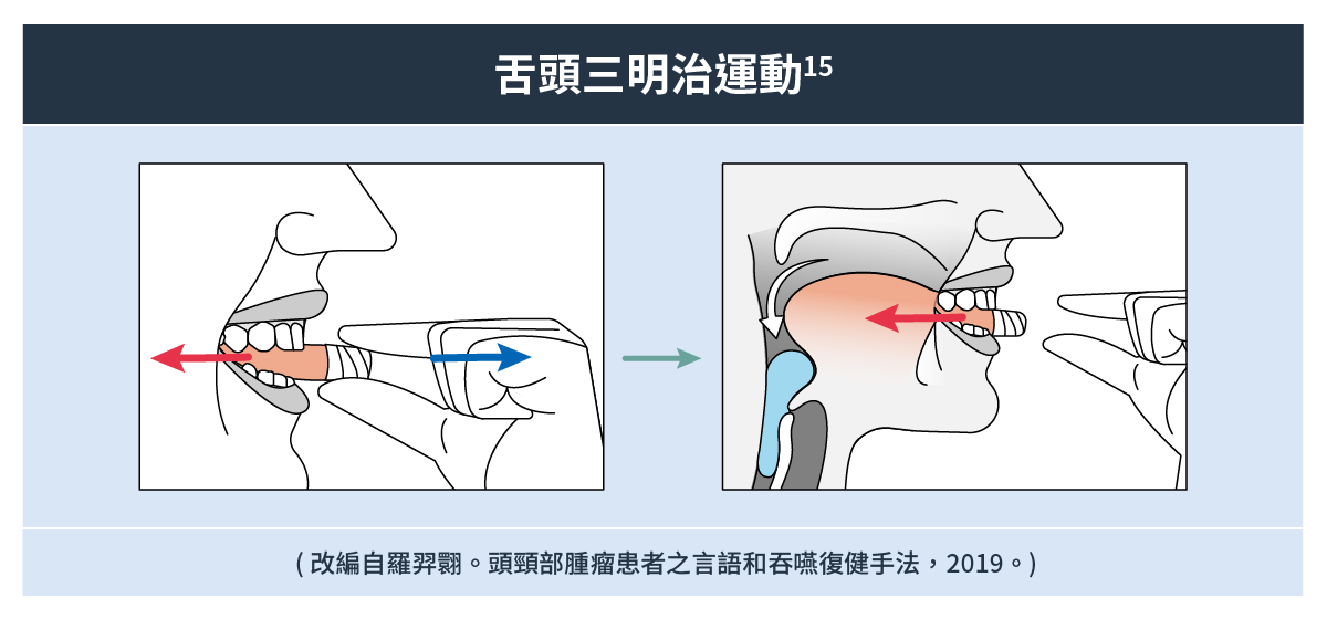 舌頭三明治運動