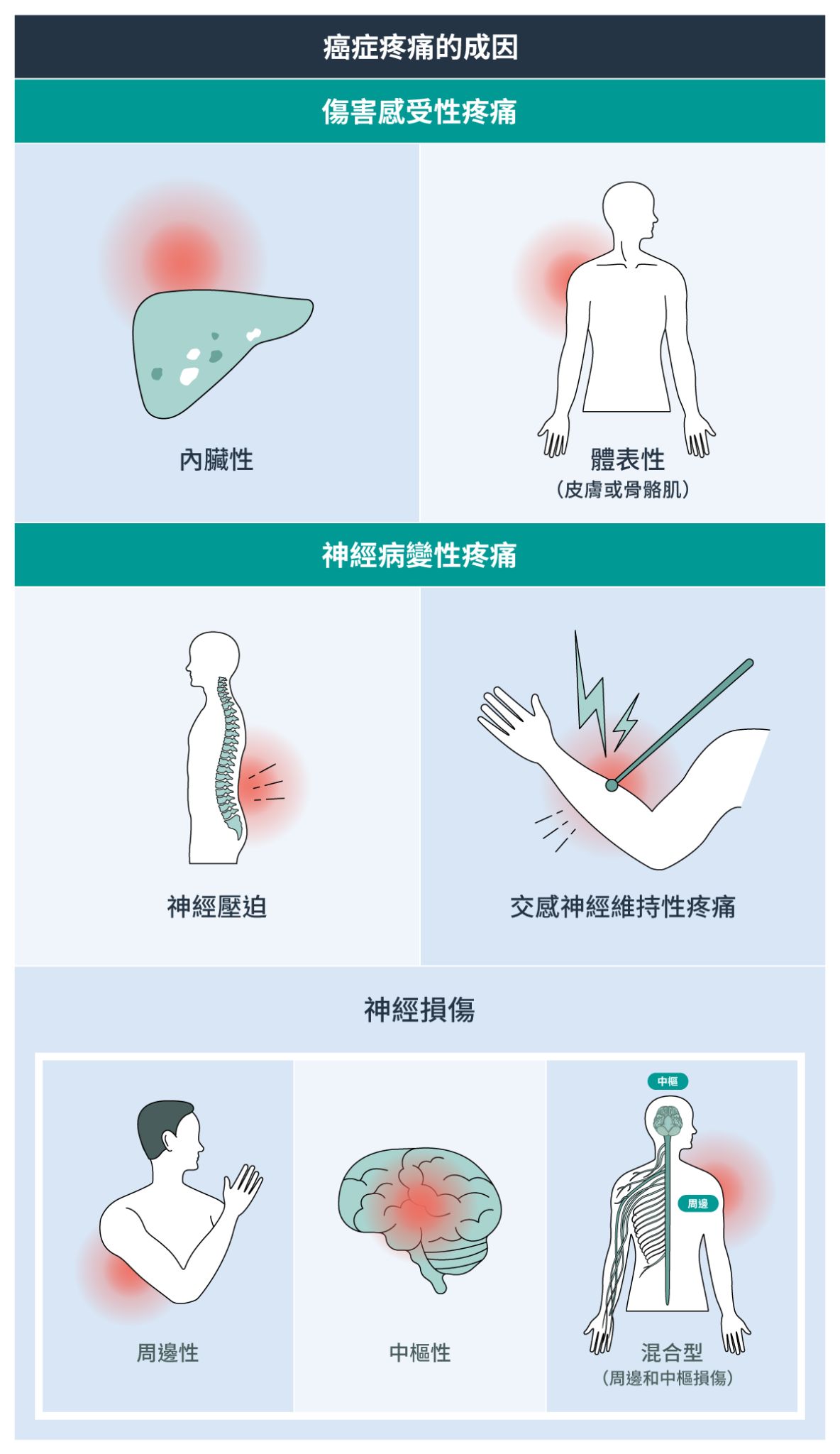 癌症疼痛的成因