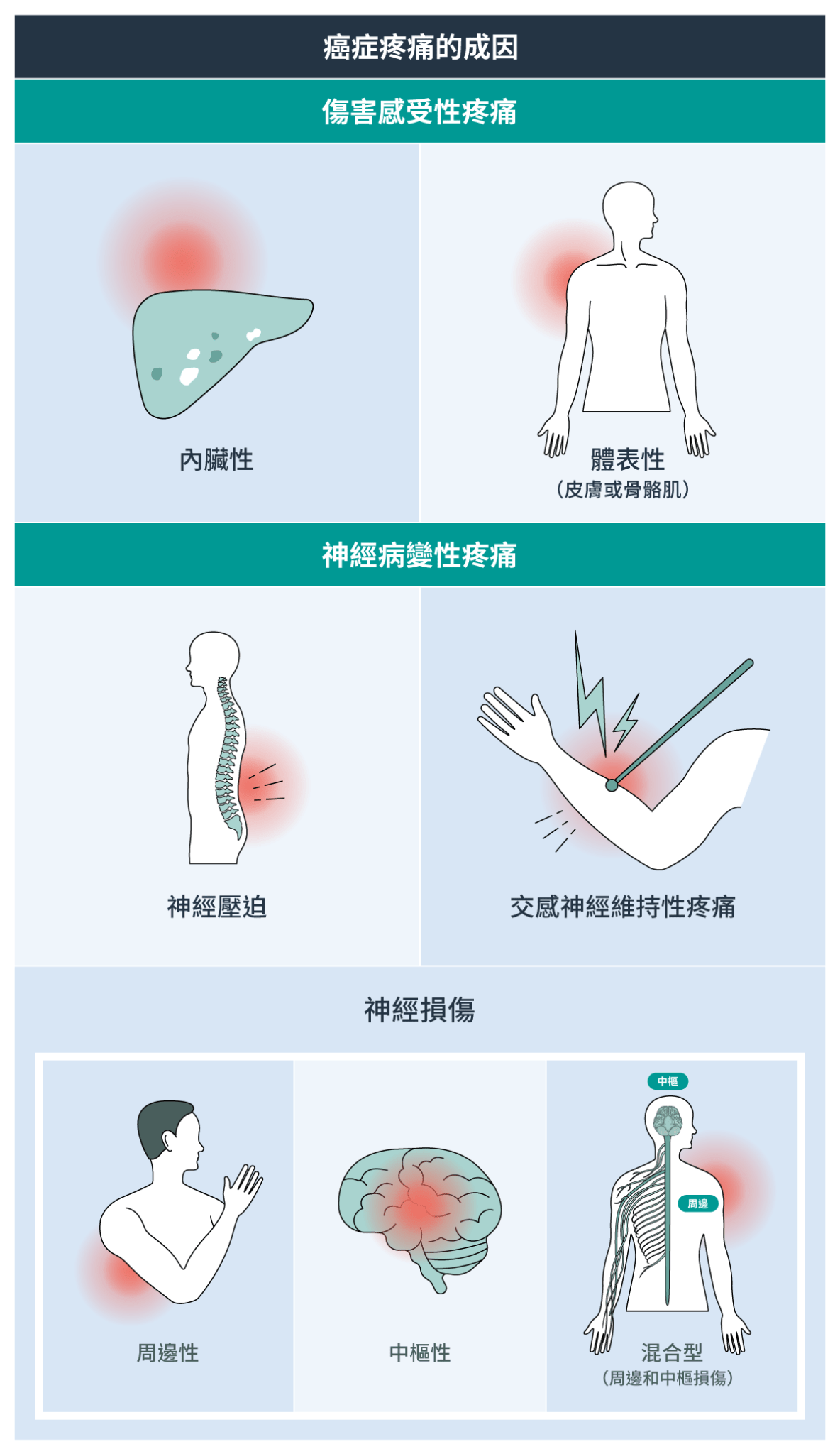癌症疼痛的成因