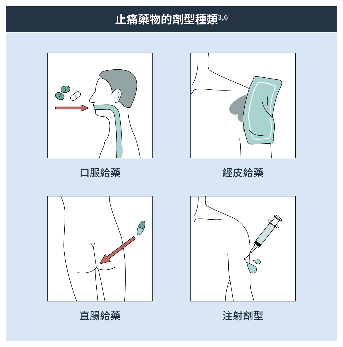 止痛藥物的劑型種類