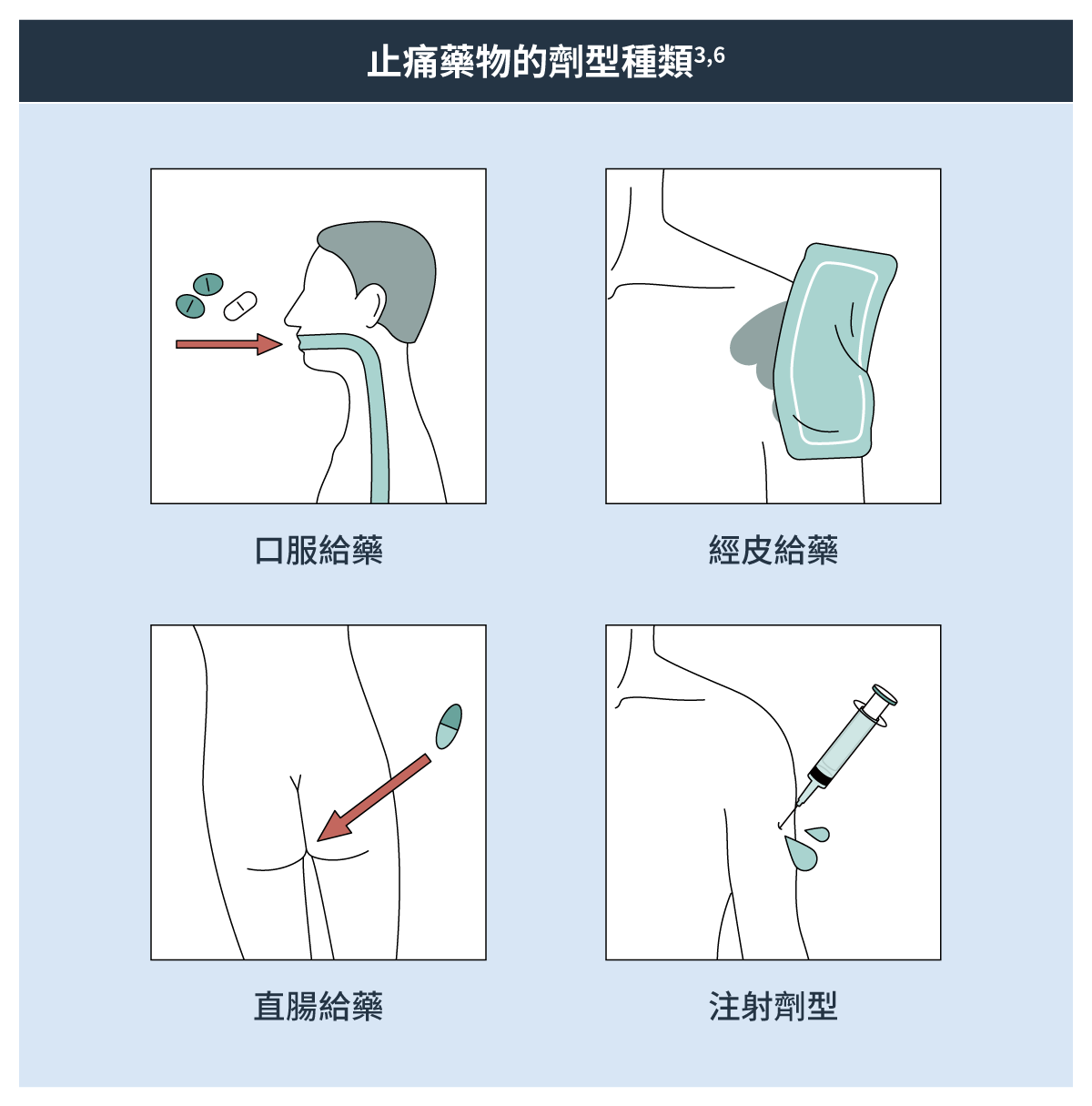 止痛藥物的劑型種類