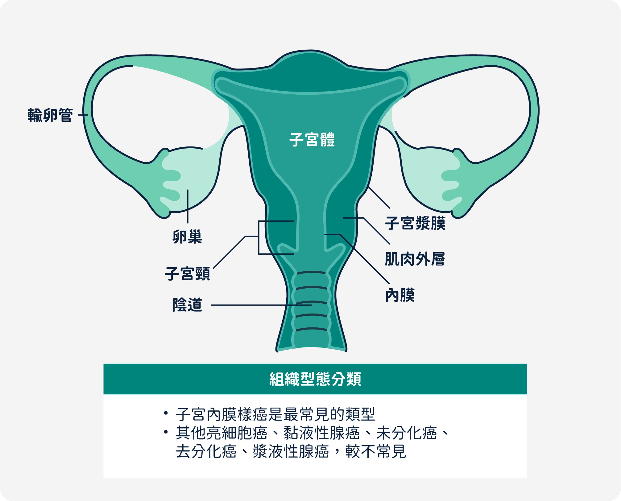 子宮內膜癌組織型態分類